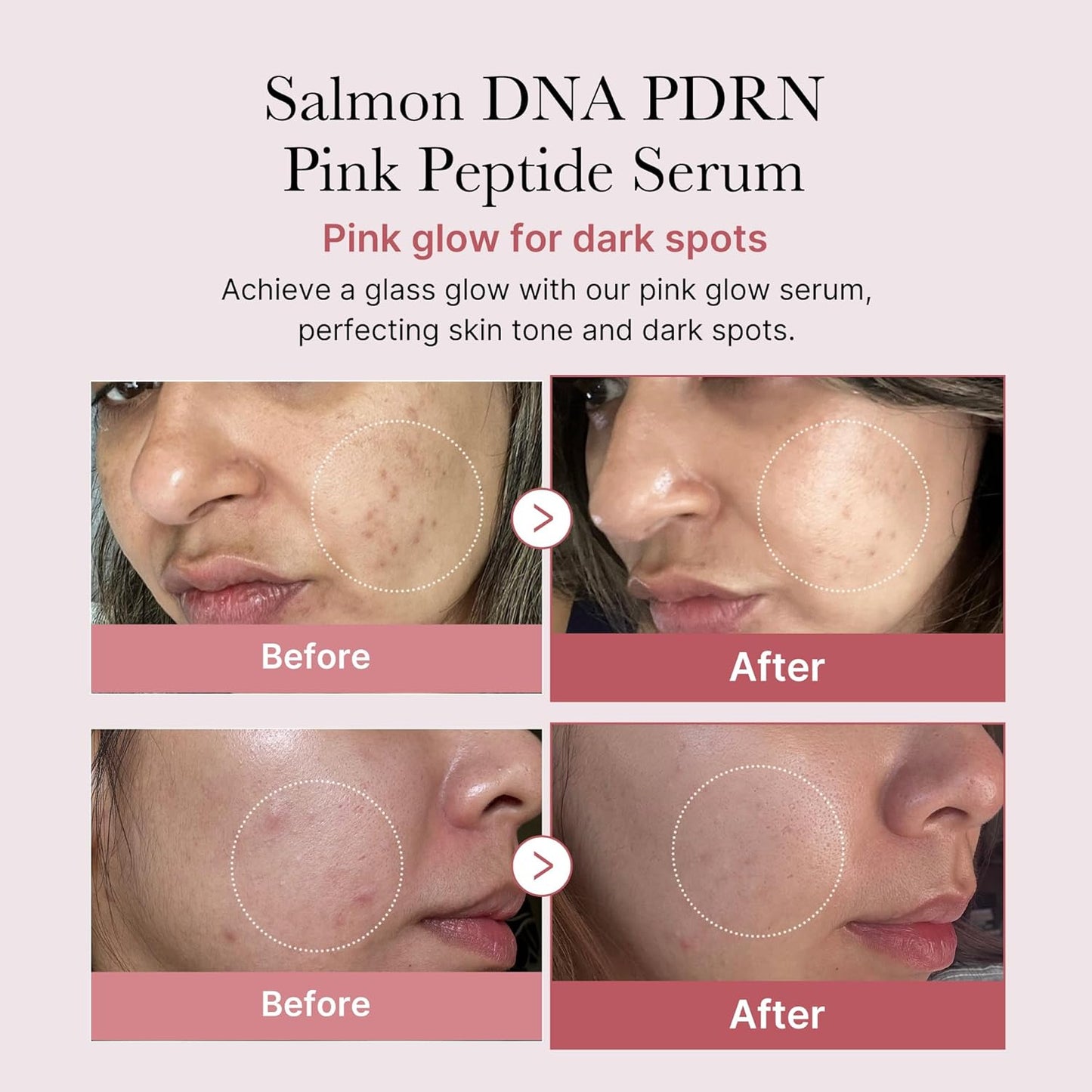 Medicube PDRN Pink Peptide Serum-30ml