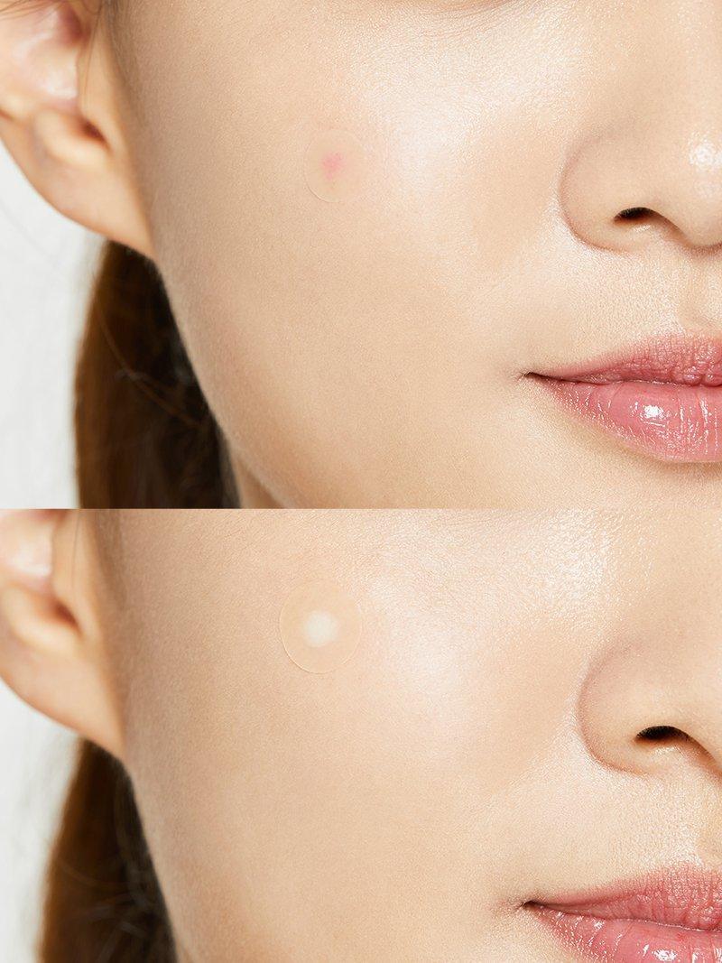 COSRX Acne Pimple Master Patch 24 Patches